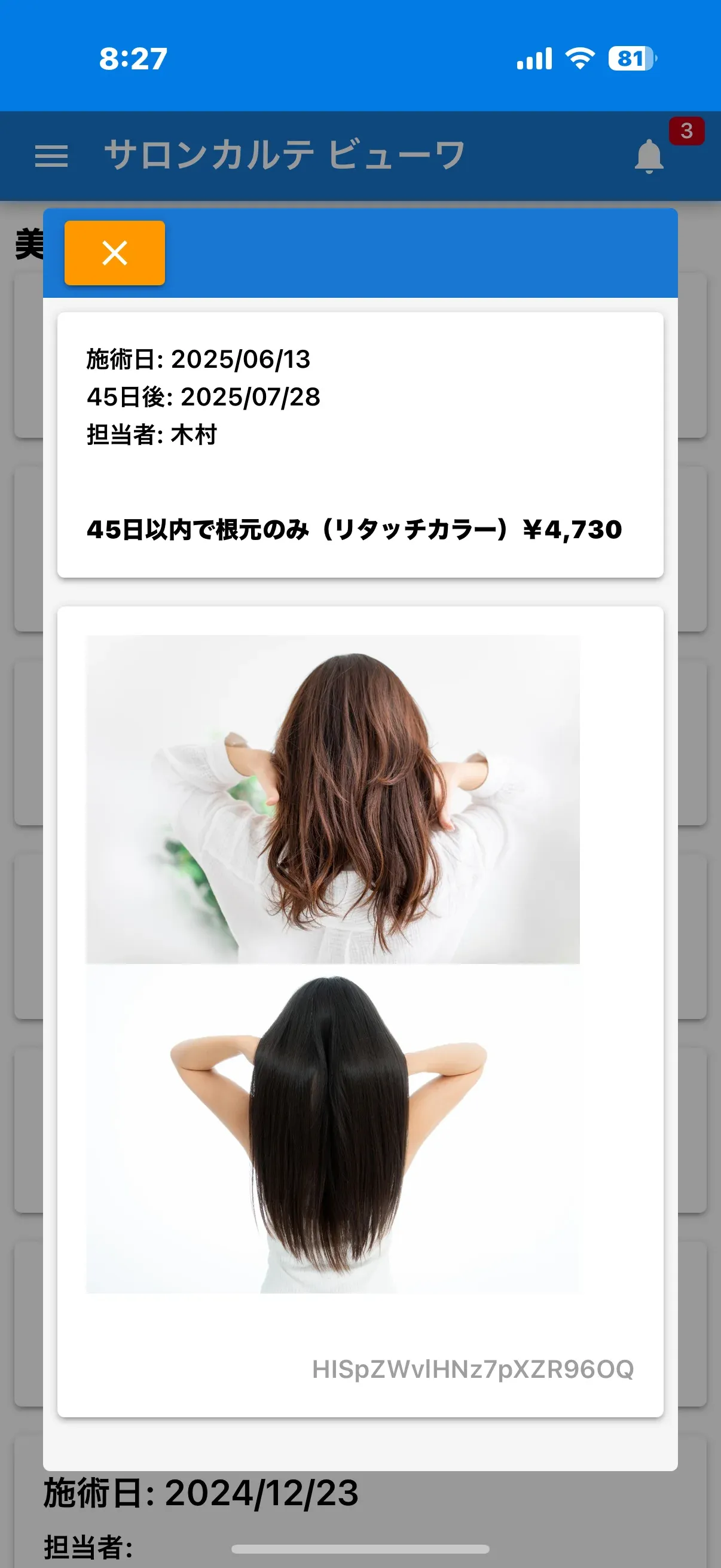 サロンカルテのカルテ作成画面。公開する情報と非公開にする情報を個別に選択できる。デフォルトでは非公開になっている。